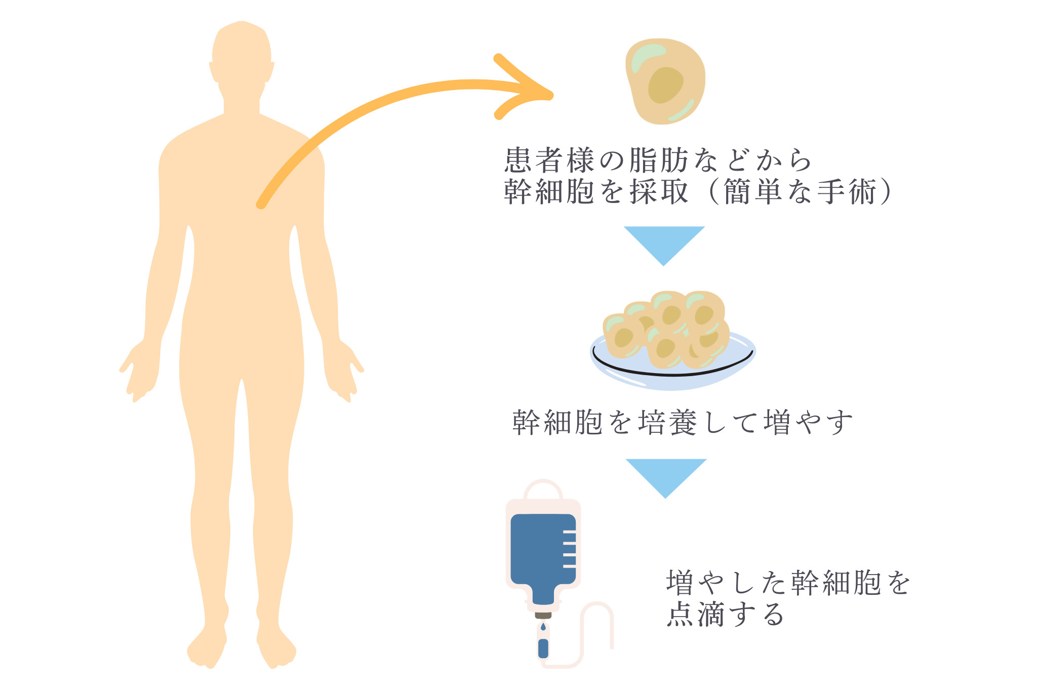 幹細胞治療とは